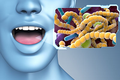 Howard I. Deutsch, DDS | Preventative Program, Implant Dentistry and Dental Fillings