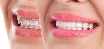 Howard I. Deutsch, DDS | Dentures, Dental Fillings and Dental Cleanings