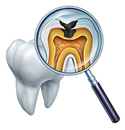 Howard I. Deutsch, DDS | Emergency Treatment, Oral Exams and Crowns
