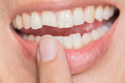 Howard I. Deutsch, DDS | Extractions, Dental Bridges and Emergency Treatment