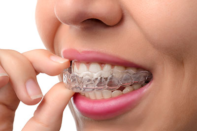 Howard I. Deutsch, DDS | Dental Fillings, Extractions and Night Guards