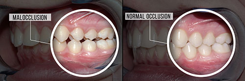 Howard I. Deutsch, DDS | Oral Exams, Veneers and Extractions