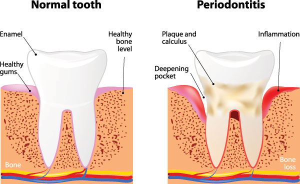 Howard I. Deutsch, DDS | Dentures, Root Canals and Crowns