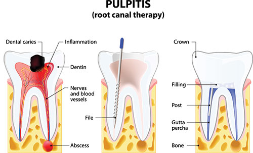 Howard I. Deutsch, DDS | Emergency Treatment, Crowns and Dental Fillings