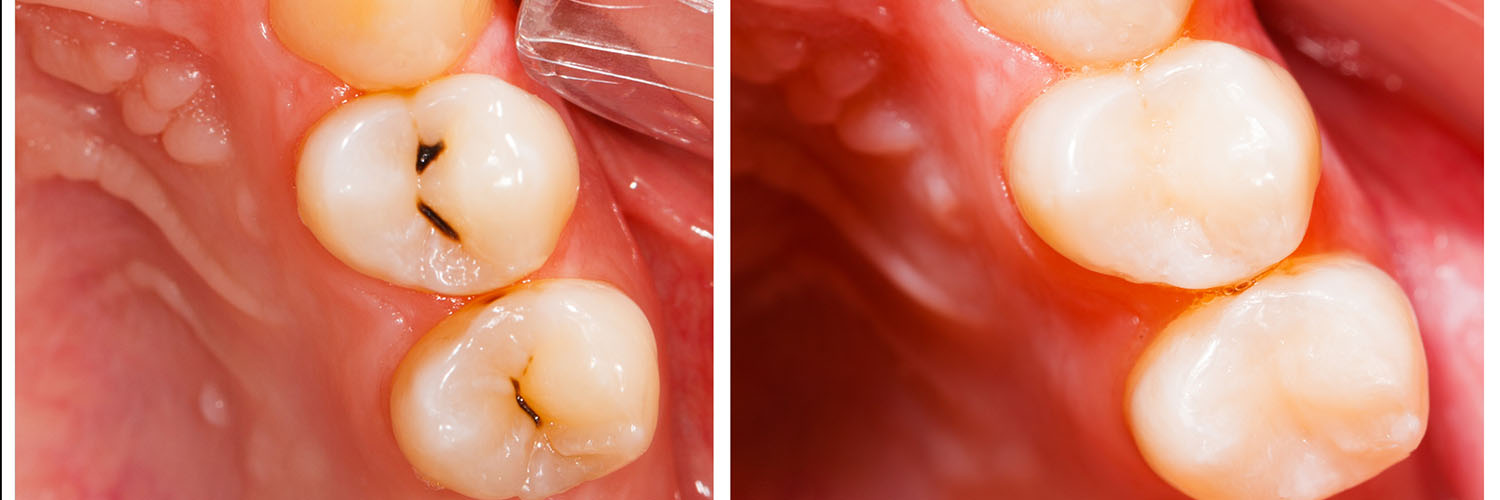Howard I. Deutsch, DDS