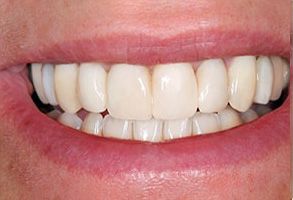 Howard I. Deutsch, DDS | Digital Radiography, Preventative Program and Implant Dentistry